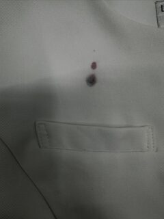 うっかりポケットにボールペンを入れたまま洗濯…

結構、多い相談です

で、1番やらない方がいいことは

自分で処理してしまうこと

慌てて色々やりたくなる気持ちはわかりますが

何もせずそのままお持ち下さい

今回は何とか落とせましたが、いじってしまうと落としにくくなることも多い

インクだけでなく、シミが着いたらなるべく早くお持ち下さい

全力で処理します

ちなみに

インクは溶かして落とします！

#洗濯トラブル
#インクの染み
#ボールペンうっかり
#染み抜き専門
#クリーニングのプロ
#手間なく安心
#洗濯の悩み
#染み抜きサービス
#プロの技術
#お任せください
#お客様の声
#インク落とし
#洗濯の失敗
#ポケットの中身
#クリーニング店
#おうちケア
#安心サービス
#トラブル解決
#きれいを取り戻す
#染み抜きのプロ
#クリーニングで解決
#インク処理
#洗濯SOS
#心配無用